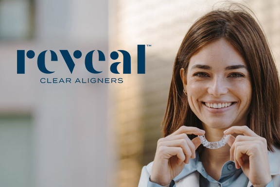 Reveal clear orthodontic aligners dentist East Kilbride, Glasgow