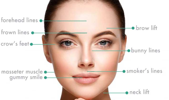 anti-wrinkle injections in East Kilbride, Glasgow