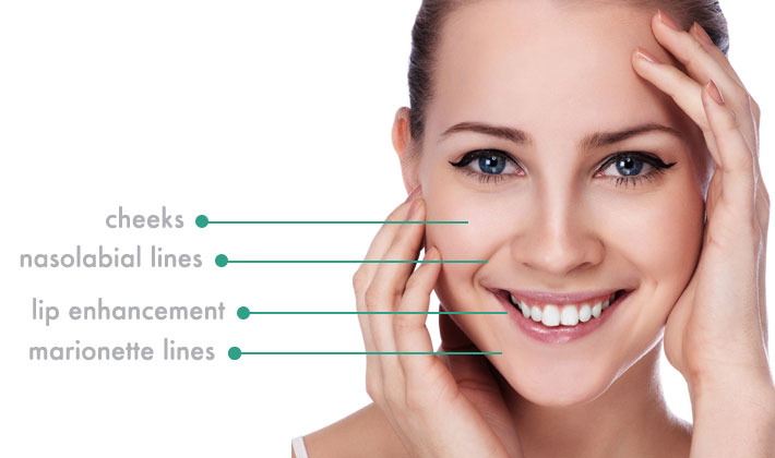 dermal fillers in East Kilbride, Glasgow